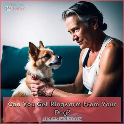 Can You Get Ringworm From Your Dog