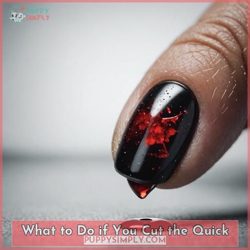 What to Do if You Cut the Quick