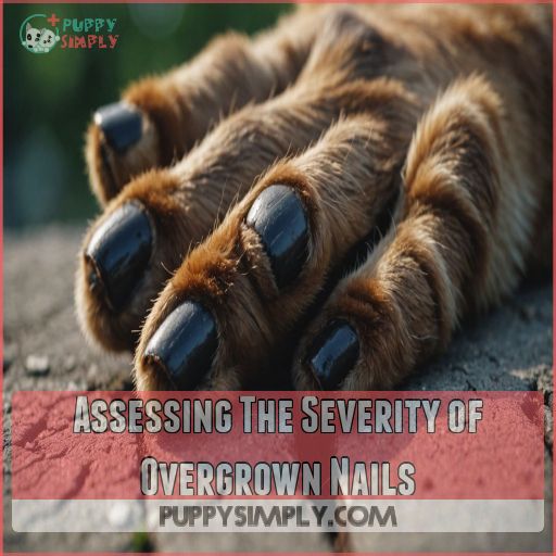 Assessing The Severity of Overgrown Nails