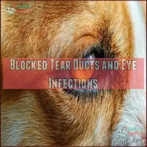Blocked Tear Ducts and Eye Infections