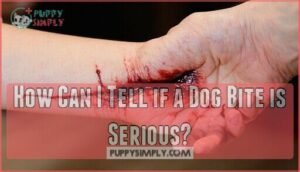 how can i tell if a dog bite is serious