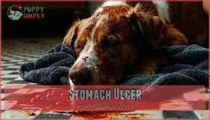stomach ulcer