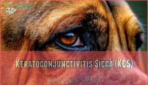 keratoconjunctivitis sicca (kcs)